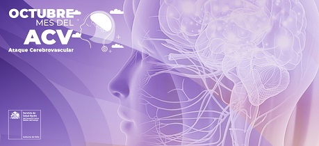 Ataque Cerebro Vascular: ¿Por qué prevenirlo?