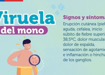 Instituto de Salud Pública confirma nuevo caso de viruela símica en Aysén
